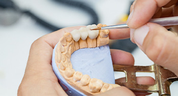 Model of dental bridge