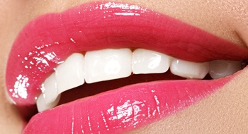 close-up of beautiful smile after cosmetic dentistry in Daytona Beach