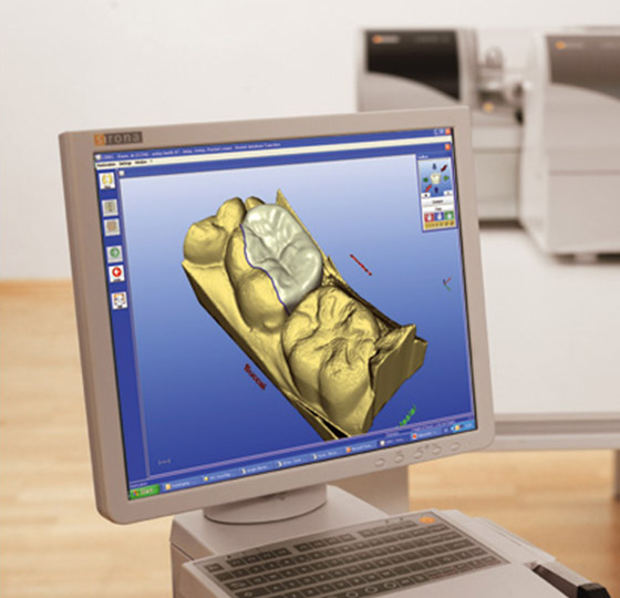 Screen showing digital imaging for dental crowns