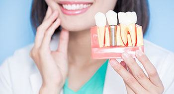 Female dentist holding a dental implant model