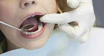 Close up of teeth being examined