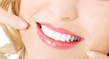 blond woman smiling and pointing at beautiful teeth