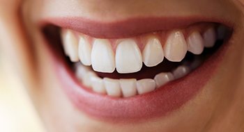 Closeup of gorgeous teeth