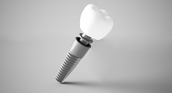 dental implant post with abutment and crown 