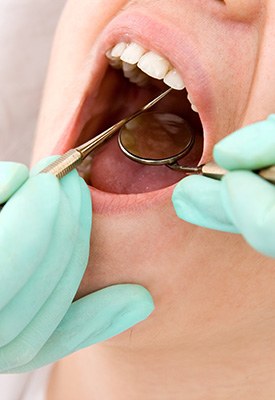 Dentist in green gloves examining patient’s cavity