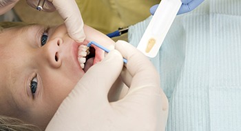 Child receiving dental sealants