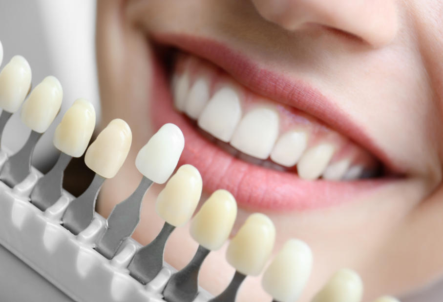 Woman smiling with teeth whitening gradient